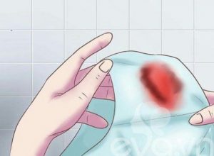 Biểu hiện viêm cổ tử cung nhẹ