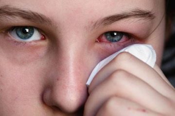 bệnh đau mắt đỏ là gì?